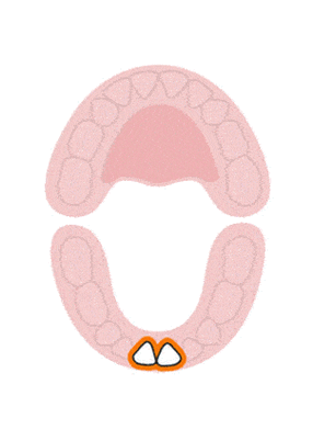 儿童换牙顺序图儿童牙齿都会换吗
