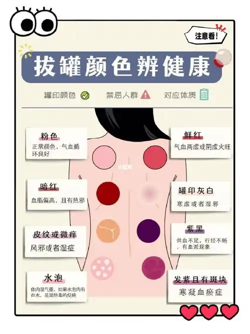 拔罐最全养生指南73不同颜色辨健康养生必看
