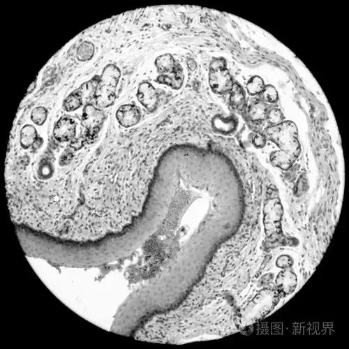 分层的鳞状上皮