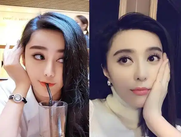 纪实深圳网红花800万整成范冰冰嫁给主刀医生如今她怎样了