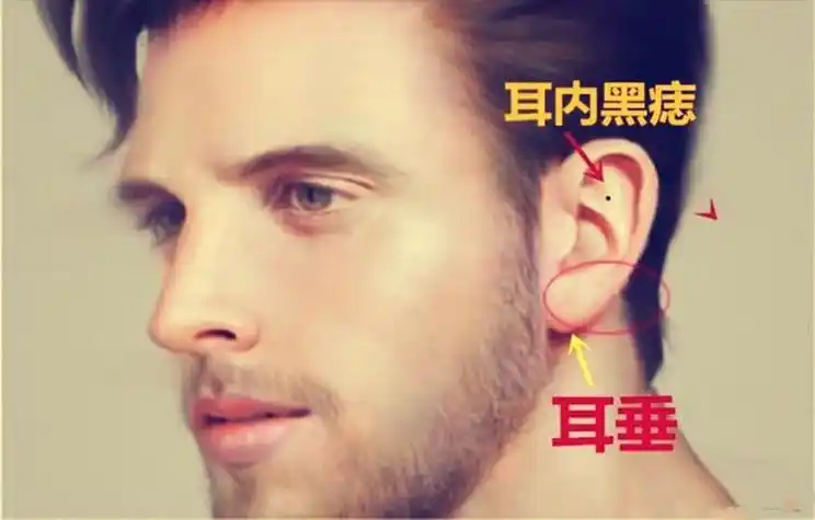 耳朵生毛吉凶如何 耳朵生毛怎样办-神算网