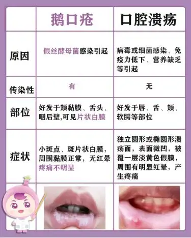 那些年家长误以为的"口腔溃疡",可能是"鹅口疮"!_孩子_宝宝_内江市