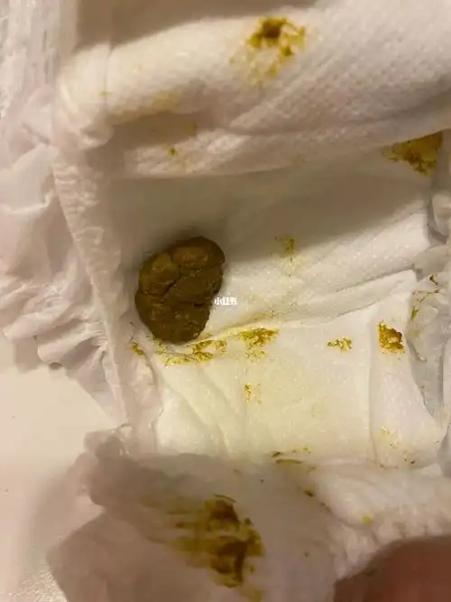 关于宝宝拉臭臭的事儿
