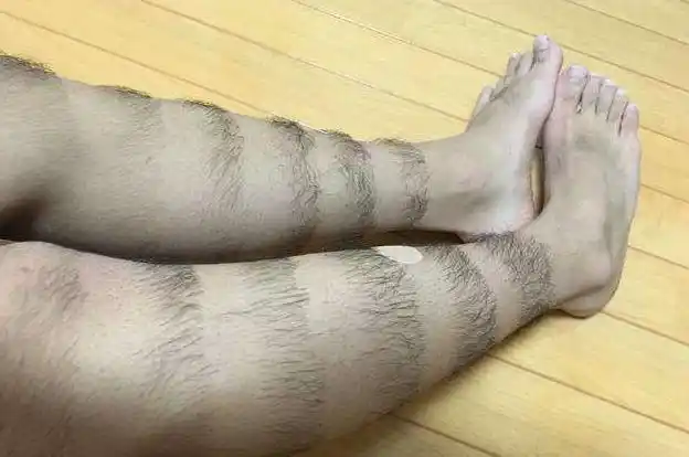 为啥有的女性毛发旺盛,有的却"光秃秃"?看完或许就了解了