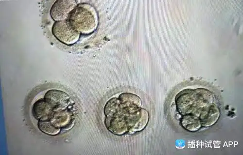 [试管婴儿]第三天的胚胎(如图).请问可以