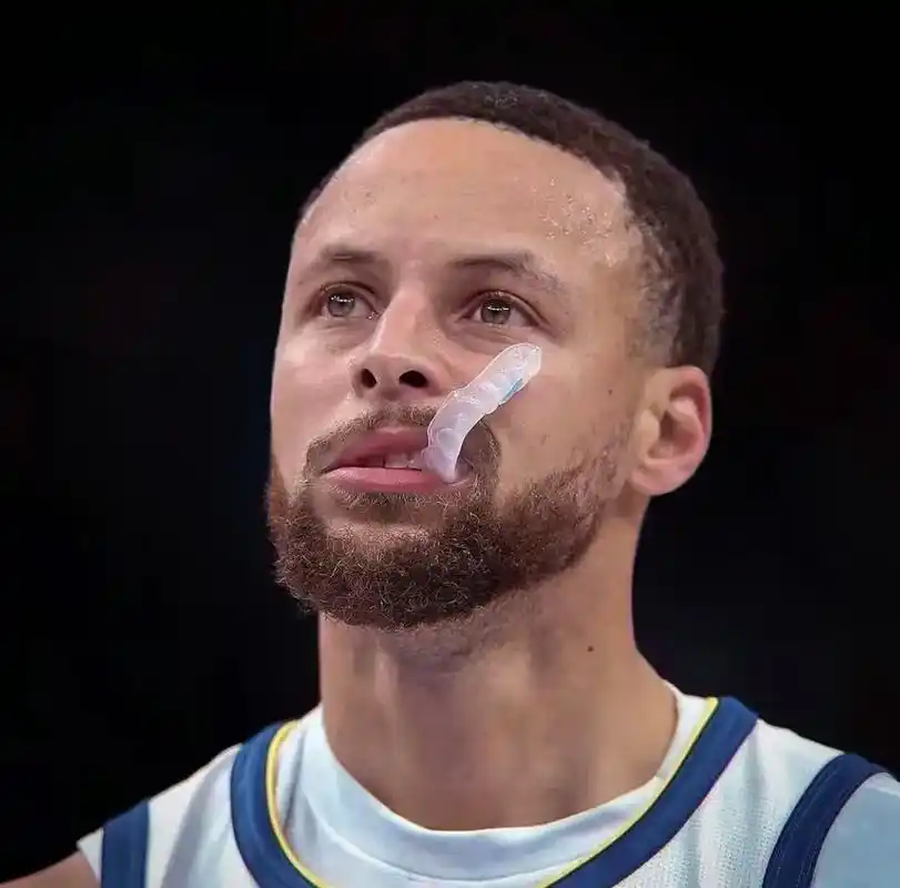 库里咬牙套合集#篮球90 #最喜欢的nba球星 #斯蒂芬库里 - 抖音