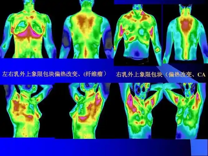红外热成像诊断图谱