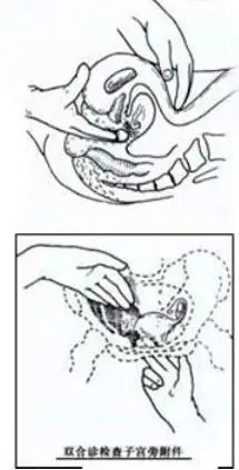 如图所示,双合诊的检查方法下面哪一项步骤不对()