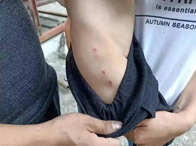 事发隆林一儿童被流浪狗咬伤警方果断击毙