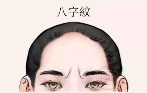 仲易说:有这4种印堂纹,生活不顺运势差,可别老皱眉了!