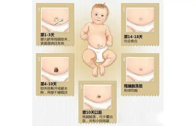 头条问答 - 顺产出院后,应该注意哪些问题?(2个回答)