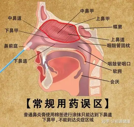 怎么治鼻炎初源告诉你