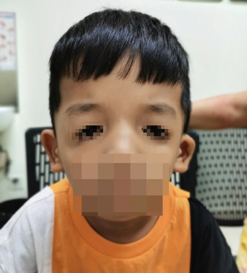 是由于胚胎7～8周以前第一,二腮弓发育异常所致畸形.