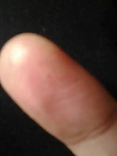 手指上一点一点的,好像里面空了一样,是怎么回事啊?