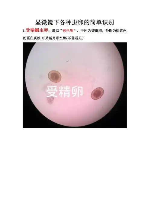 桑葚树根的功效与作用_沙棘树叶的功效和作用_轴树的作用与功效