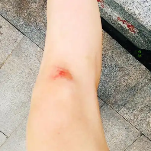 看来跑步不能想心事 今天出师不利 第一圈就摔成这样 也是尴尬了 幸好