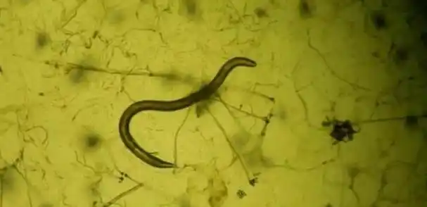 显微镜下的弓形虫