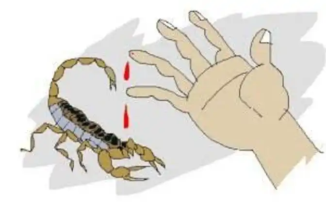 被蝎子蛰了怎么办? 老人被蝎子蛰了怎么办