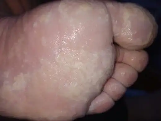 脚特别臭 还出汗 一天下来根本闻不了 特别臭