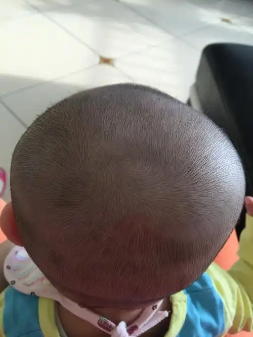 女宝 剃完头发现有两个旋 旋转的方向还不一样_百度宝宝知道