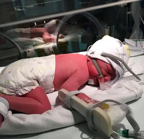 六个月是不会自然分娩的,那属于早产儿,成活率很低,如果生下来要到