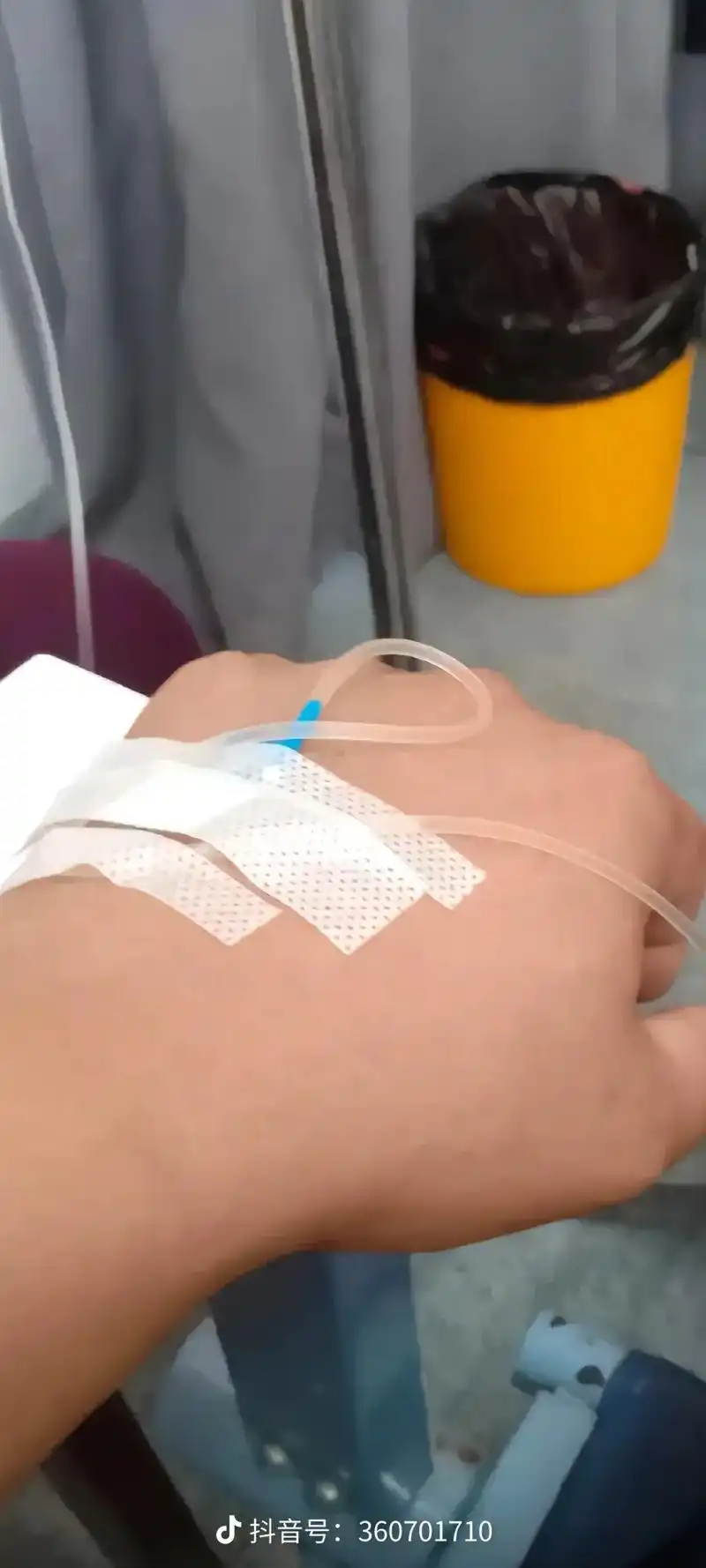 中暑了,喝完药也不怎么好,只能挂吊瓶了,有人问我为什么扎针要 - 抖音