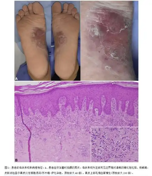 10年后患者再次就诊,尽管他重新使用了以暗拇Ψ揭