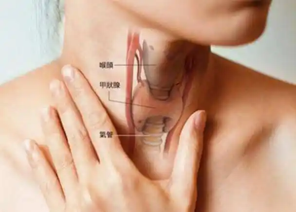 身体3处不适帮你区分_治疗_甲状腺_疾病