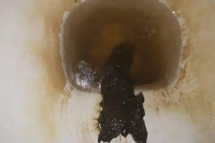 大便出血症状图片