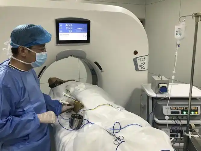 大同市五医院肿瘤科独立完成1例肝癌射频消融术