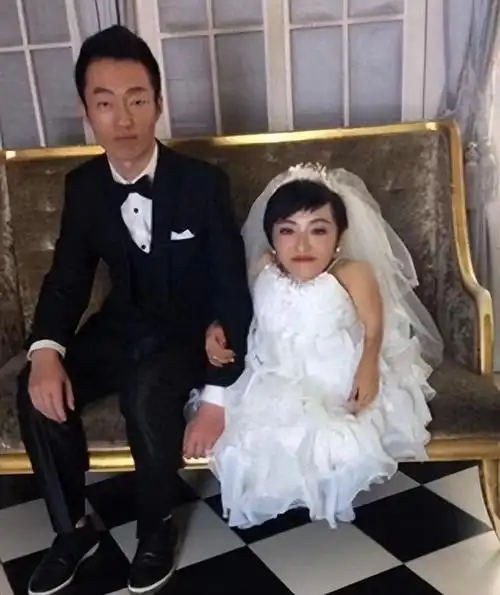 身高80厘米,身价过亿的"袖珍总裁",连嫁两任帅小伙,冒死生娃