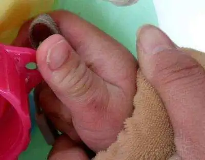 为阻止4个月儿子吃手指, 妈妈的做法, 结果却害了宝宝