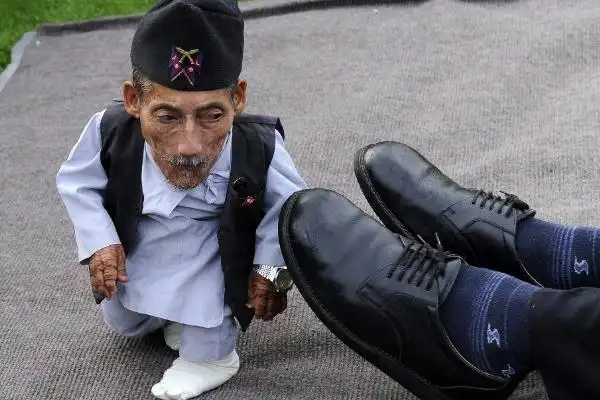 世界最矮的人身高仅546厘米比1岁小孩还矮