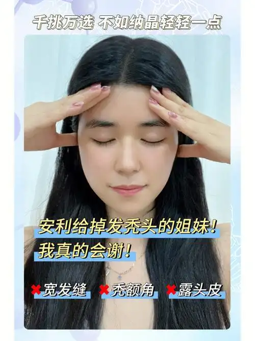 折扣01戴发片特别考验手法,还得时刻害怕它掉下来假发套更是伤毛囊