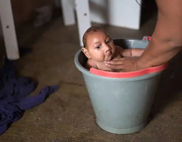 巴西罕见病毒致婴儿患"小头症"