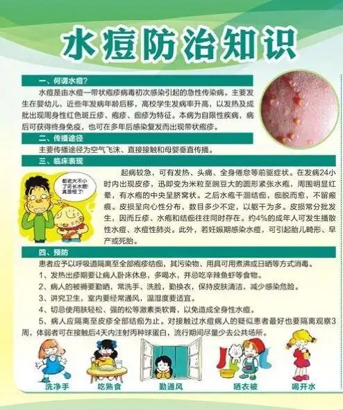 水痘知识宣传——屯铺小学