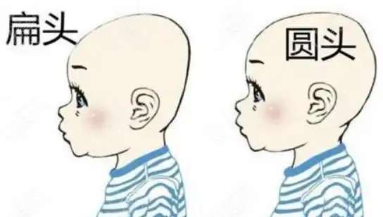 扁头圆头对比