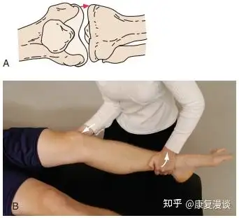 外翻/应力外翻试验是评价膝关节内侧不稳定的方法,也就是检查胫骨在