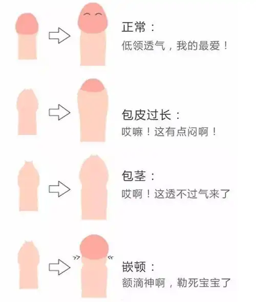 医课堂|八张高清萌图告诉你,孩子的包皮要不要割