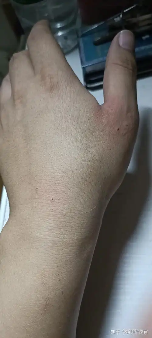 被2个月的小猫咬了? - 知乎