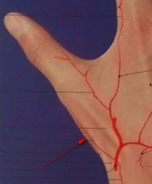 第1掌骨桡侧背动脉如果皮瓣的血液供应来自一个独立,稳定的血管束的话