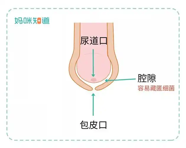 所以年龄小的孩子,包皮不可以强行上翻!