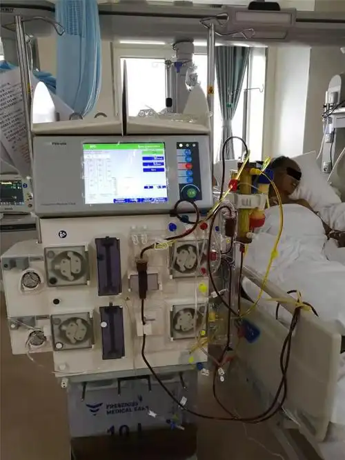 我院成功实施一例dpmas人工肝治疗