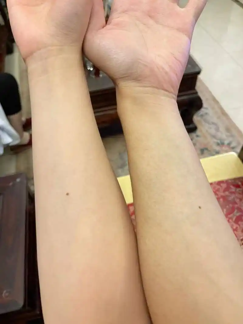 none 玄学!手臂内壁都有颗痣唉