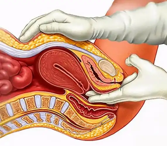 食指和中指,一根手指或者两根,探入阴道内,置于宫颈或者后穹窿的位置