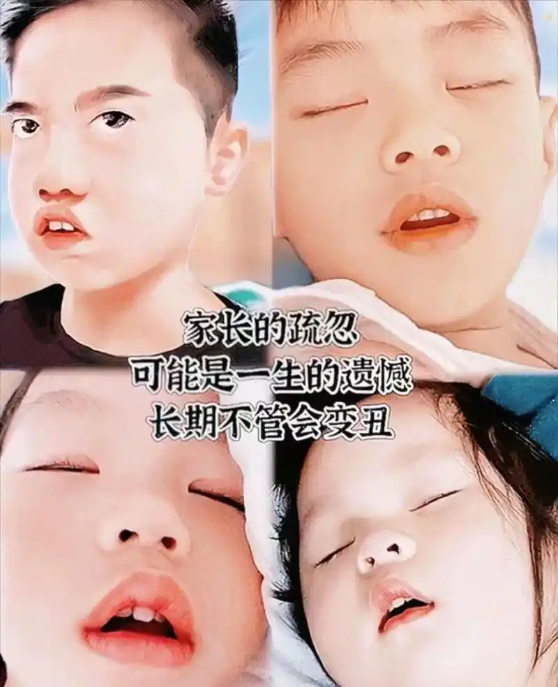 解决翘唇好方法.