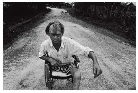 日本福岛核辐射后惨象触目惊心