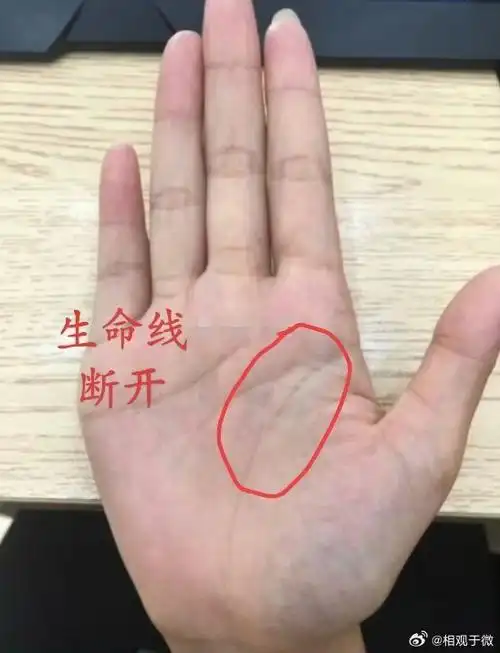 生命线浅细,或者断断续续的,其人一般体质偏弱,抗病能力差,一点小感冒