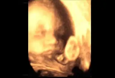 b超中的胎宝宝,千姿百态好可爱__网易亲子