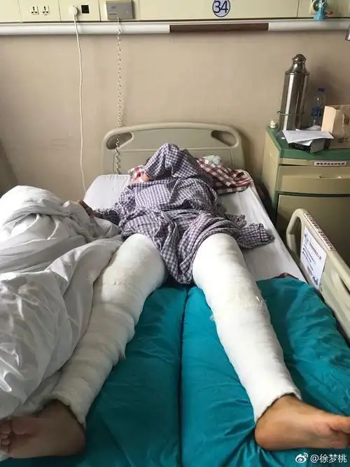 徐梦桃术后泪眼婆娑 称10年做4次的手术心里难受